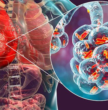 sicaklarla-yayilimi-artan-enfeksiyonlardan-basit-onlemlerle-korunmak-m_3f3c7509