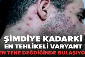 manset simdiye kadarki en tehlikeli varyant ten tene degdiginde bulasiyor