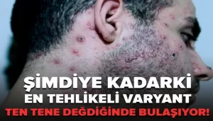 manset-simdiye-kadarki-en-tehlikeli-varyant-ten-tene-degdiginde-bulasiyor