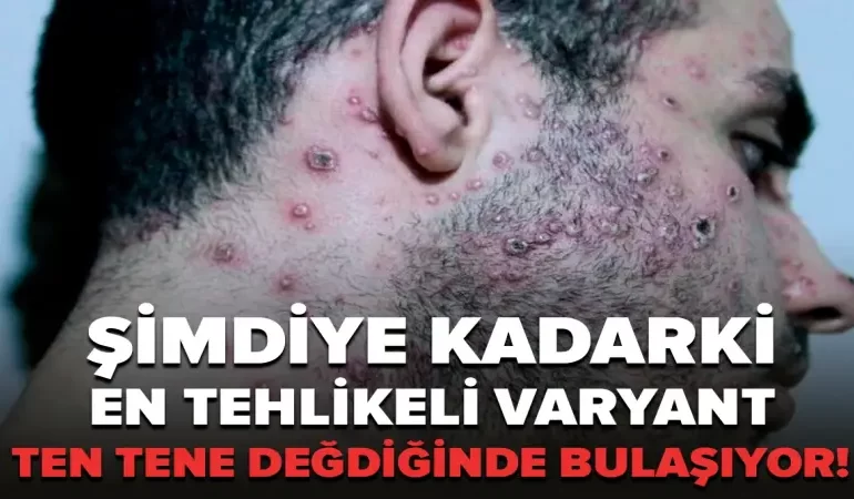 manset-simdiye-kadarki-en-tehlikeli-varyant-ten-tene-degdiginde-bulasiyor